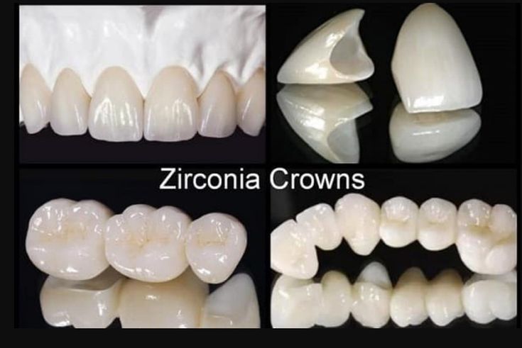 Zirconia