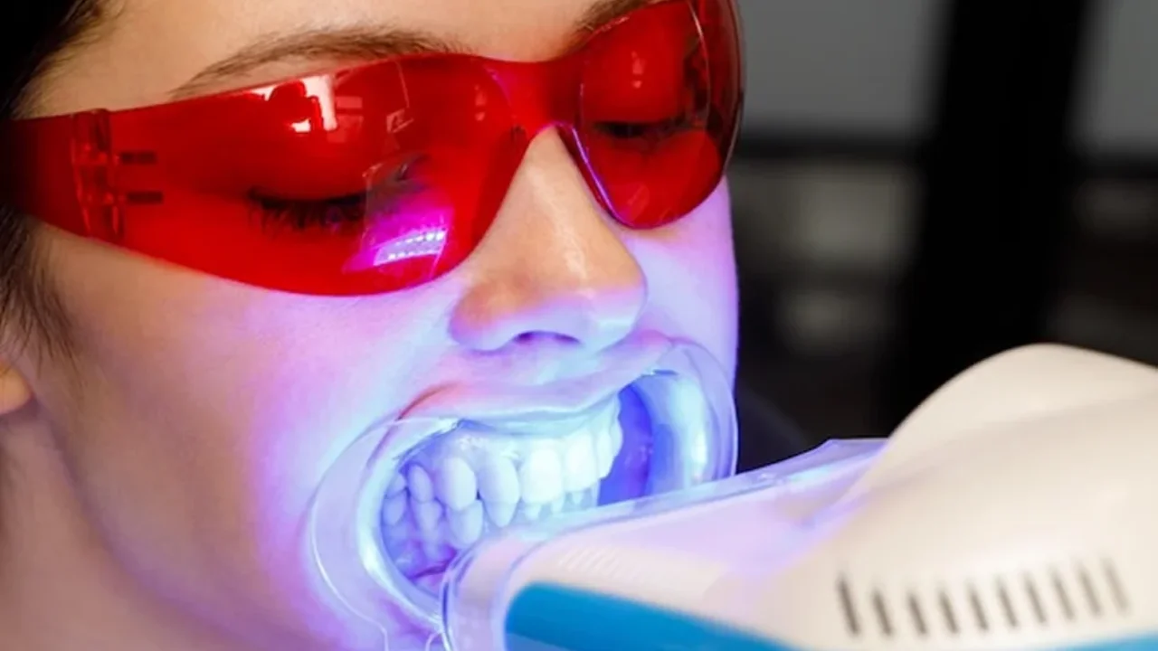 ฟอกสีฟัน zoom ราคา