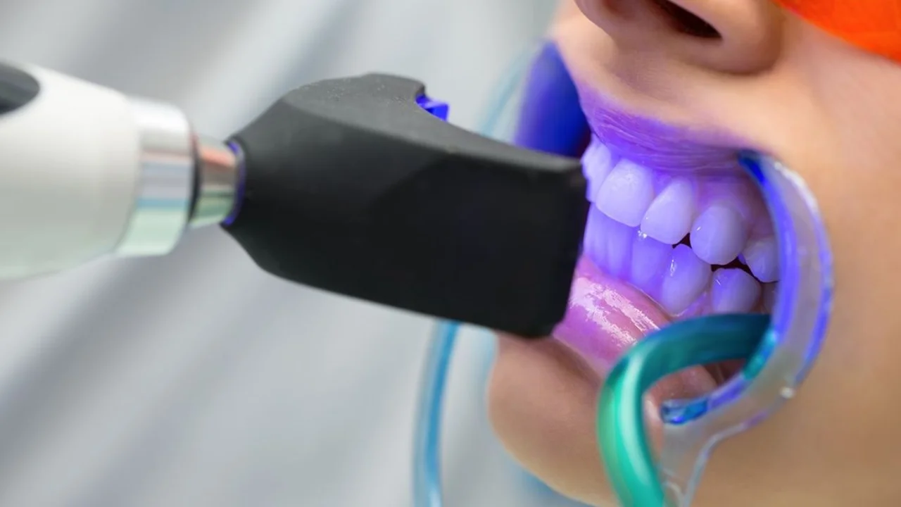 ฟอกสีฟัน Cool Light