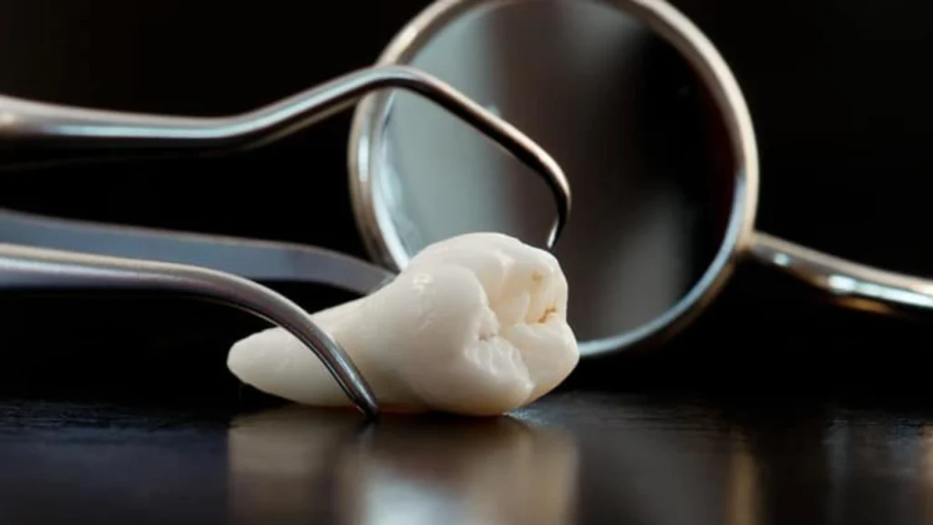 ถอนฟันคุดอันตรายหรือไม่